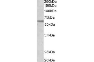 ABIN185181 (2µg/ml) staining of MCF7 lysate (35µg protein in RIPA buffer). (ACVRL1 antibody  (C-Term))