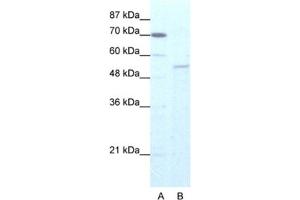Western Blotting (WB) image for anti-Zinc Finger Protein 665 (ZNF665) antibody (ABIN2461274) (ZNF665 antibody)