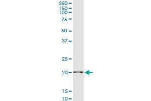 Immunoprecipitation of SAP18 transfected lysate using anti-SAP18 MaxPab rabbit polyclonal antibody and Protein A Magnetic Bead , and immunoblotted with SAP18 purified MaxPab mouse polyclonal antibody (B01P) . (SAP18 antibody  (AA 1-153))