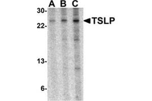 Western blot analysis of TSLP in A-20 cell lysate with AP30965PU-N TSLP antibody at 0. (Thymic Stromal Lymphopoietin antibody  (Center))