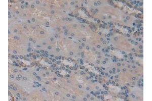 IHC-P analysis of Human Kidney Tissue, with DAB staining. (IGFBP6 antibody  (AA 31-240))