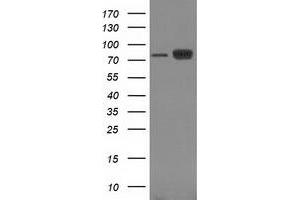 Image no. 5 for anti-Catenin (Cadherin-Associated Protein), beta 1, 88kDa (CTNNB1) antibody (ABIN1496890) (CTNNB1 antibody)