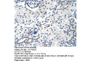 Rabbit Anti-SNRPA Antibody  Paraffin Embedded Tissue: Human Kidney Cellular Data: Epithelial cells of renal tubule Antibody Concentration: 4. (SNRPA1 antibody  (Middle Region))