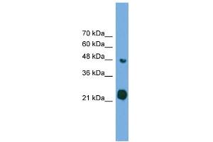 WB Suggested Anti-RAB37 Antibody Titration: 0. (RAB37 antibody  (Middle Region))