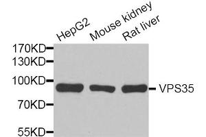 Western blot analysis of extracts of various cell lines, using VPS35 antibody. (VPS35 antibody)