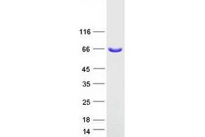 Validation with Western Blot