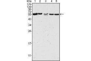 Western blot analysis using PAK2 mouse mAb against Hela (1), Jurkat (2), A549 (3), HEK293 (4) and K562 (5) cell lysate. (PAK2 antibody)