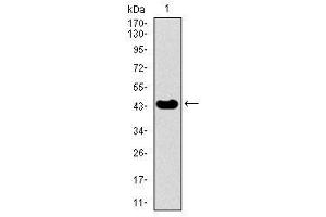 Image no. 4 for anti-Thyroid Hormone Receptor Interactor 6 (TRIP6) antibody (ABIN1490826) (TRIP6 antibody)