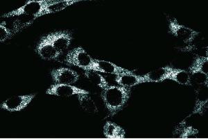 Immunoflourescence staining of RSV-3T3 cells. (NEDD4 antibody  (AA 173-262))