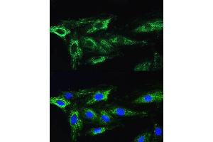 Immunofluorescence (IF) image for anti-ATG16 Autophagy Related 16-Like 1 (ATG16L1) (AA 200-300) antibody (ABIN6137248)