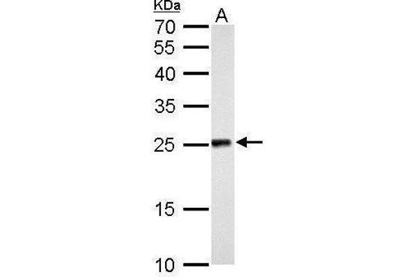 NDUFV2 antibody  (Center)