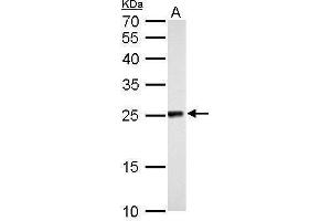 WB Image NDUFV2 antibody detects NDUFV2 protein by Western blot analysis. (NDUFV2 antibody  (Center))
