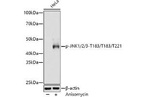 Western blot analysis of extracts of HeLa cells, using Phospho-JNK1/2/3-T183/T183/T221 antibody (ABIN6135251, ABIN6135990, ABIN6135991 and ABIN7101879) at 1:3000 dilution. (MAPK8/9/10 antibody  (pThr183, pThr221, Thr183))