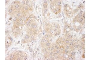 Immunohistochemistry (IHC) image for anti-Sorting Nexin 1 (SNX1) (C-Term) antibody (ABIN7448807) (Sorting Nexin 1 antibody  (C-Term))