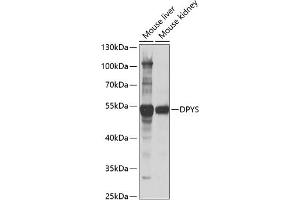 Western blot analysis of extracts of various cell lines, using DPYS antibody (ABIN6127809, ABIN6139809, ABIN6139810 and ABIN6221986) at 1:1000 dilution. (DPYS antibody  (AA 250-519))