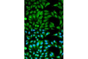 Immunofluorescence analysis of HeLa cells using PARK2 antibody (ABIN5970356). (Parkin antibody)