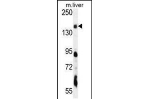 Western blot analysis in mouse liver tissue lysates (35ug/lane). (PIK3C2A antibody  (C-Term))