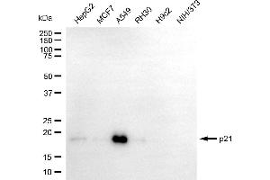 Western blotting analysis using p21 antibody (ABIN7798222). (Recombinant p21 antibody)