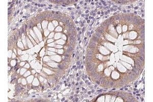 Phospho-AMPK alpha (Thr172) Antibody for IHC in human colon. (AMPK alpha antibody  (pThr172))