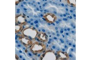 Immunohistochemical analysis of Dia 1 staining in mouse kidney formalin fixed paraffin embedded tissue section. (CYB5R3 antibody)