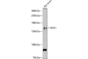 Western blot analysis of extracts of Rat brain, using NOS1 antibody (ABIN6129512, ABIN6144725, ABIN6144726 and ABIN6216548) at 1:500 dilution. (NOS1 antibody  (AA 1-180))