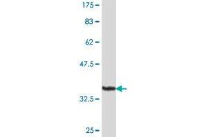 Western Blot detection against Immunogen (36. (PIP5K1A antibody  (AA 258-347))