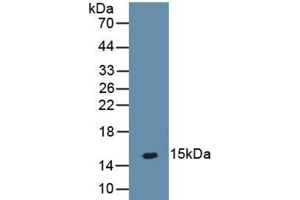 PTH2R antibody  (AA 27-145)