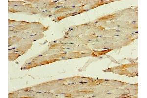 Immunohistochemistry of paraffin-embedded human skeletal muscle tissue using ABIN7142079 at dilution of 1:100 (PHPT1 antibody  (AA 1-125))