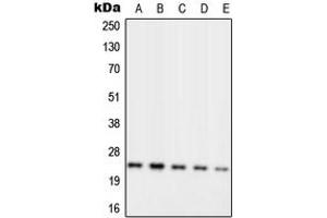 Western blot analysis of RPL10 expression in MCF7 (A), Jurkat (B), K562 (C), Raw264. (RPL10 antibody  (Center))