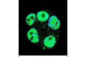 Confocal immunofluorescent analysis of METTL2 Antibody (C-term) (ABIN655892 and ABIN2845293) with ZR-75-1 cell followed by Alexa Fluor 488-conjugated goat anti-rabbit lgG (green). (METTL2 antibody  (C-Term))