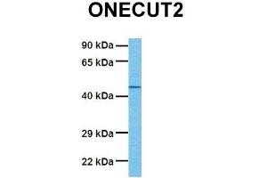 Host:  Rabbit  Target Name:  ONECUT2  Sample Tissue:  Human OVCAR-3  Antibody Dilution:  1. (ONECUT2 antibody  (Middle Region))