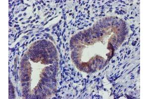 Immunohistochemical staining of paraffin-embedded Human endometrium tissue using anti-SOCS3 mouse monoclonal antibody. (SOCS3 antibody)