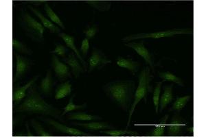 Immunofluorescence of monoclonal antibody to EIF4G2 on HeLa cell. (EIF4G2 antibody  (AA 811-889))