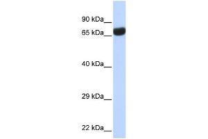 WB Suggested Anti-TPTE Antibody Titration:  0. (TPTE antibody  (Middle Region))