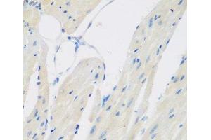 Immunohistochemistry of paraffin-embedded Mouse heart using CCL26 Polyclonal Antibody at dilution of 1:200 (40x lens). (CCL26 antibody)