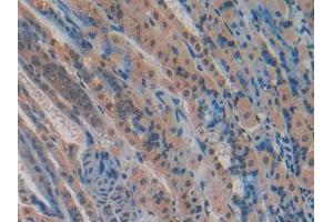 Figure. (CYR61 antibody  (AA 176-379))