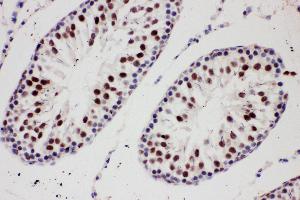 Anti-PIAS1 antibody, IHC(P) IHC(P): Rat Testis Tissue (PIAS1 antibody  (C-Term))