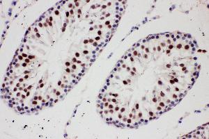Anti-PIAS1 antibody, IHC(P) IHC(P): Rat Testis Tissue