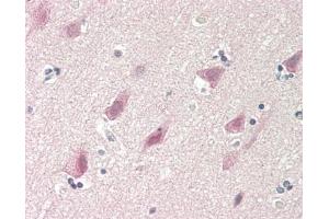 Immunohistochemistry (Paraffin-embedded Sections) (IHC (p)) image for anti-Ribosomal Protein S6 Kinase, 70kDa, Polypeptide 2 (RPS6KB2) (AA 1-100) antibody (ABIN2744142)