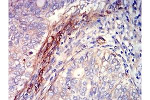 Immunohistochemistry (IHC) image for anti-Sphingosine-1-Phosphate Receptor 1 (S1PR1) antibody (ABIN7193259)