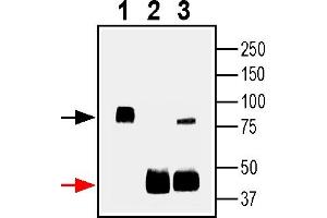 Immunoprecipitation of rat brain lysates using SV2A and isotype control antibodies1. (Rabbit IgG Isotype Control)