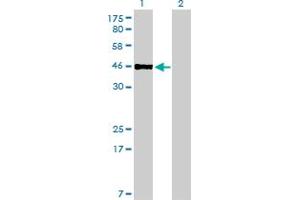 Western Blot analysis of PBX2 expression in transfected 293T cell line by PBX2 monoclonal antibody (M01), clone 2E9. (PBX2 antibody  (AA 354-430))
