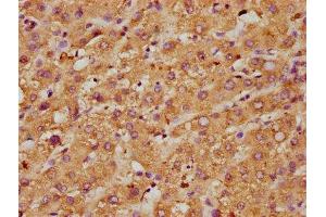 IHC image of ABIN7160488 diluted at 1:600 and staining in paraffin-embedded human liver tissue performed on a Leica BondTM system. (Myeloperoxidase antibody  (AA 165-278))
