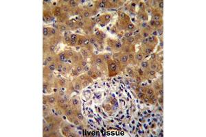Immunohistochemistry (IHC) image for anti-PHD Finger Protein 17 (PHF17) antibody (ABIN2997326)