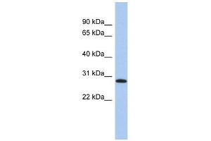 LYSMD1 antibody used at 1 ug/ml to detect target protein. (LYSMD1 antibody  (N-Term))