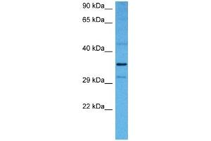 Western Blotting (WB) image for anti-NF-kappa-B inhibitor beta (NFKBIB) (N-Term) antibody (ABIN2775762)