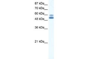 WB Suggested Anti-JMJD2D Antibody Titration:  5. (JMJD2D antibody  (C-Term))