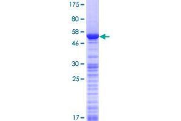 PYM Protein (AA 1-204) (GST tag)