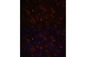 Immunofluorescence analysis of rat brain using Dopamine Transporter/SLC6 Rabbit pAb (ABIN7270474) at dilution of 1:100 (40x lens). (SLC6A3 antibody  (C-Term))