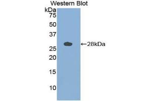 Western blot analysis of the recombinant protein. (Cathepsin S antibody  (AA 115-331))